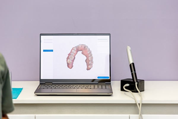 The Importance Of  D Dental Scans